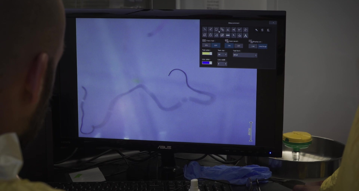 Sur l'écran d'un ordinateur, une image vue au microscope d'une microfibre de plastique.