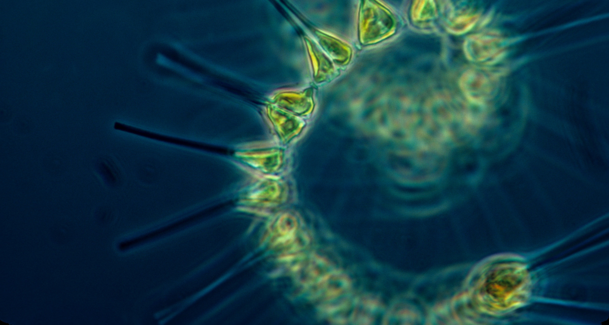 An image of phytoplankton.