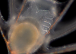 Le micromonde du plancton